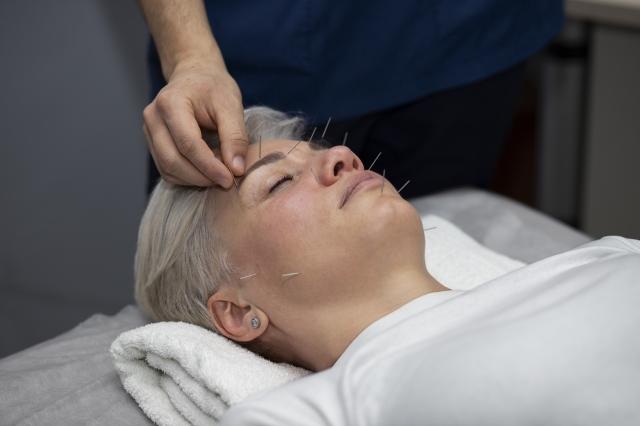 How Acupuncture Can Naturally Reduce Anxiety and Stress